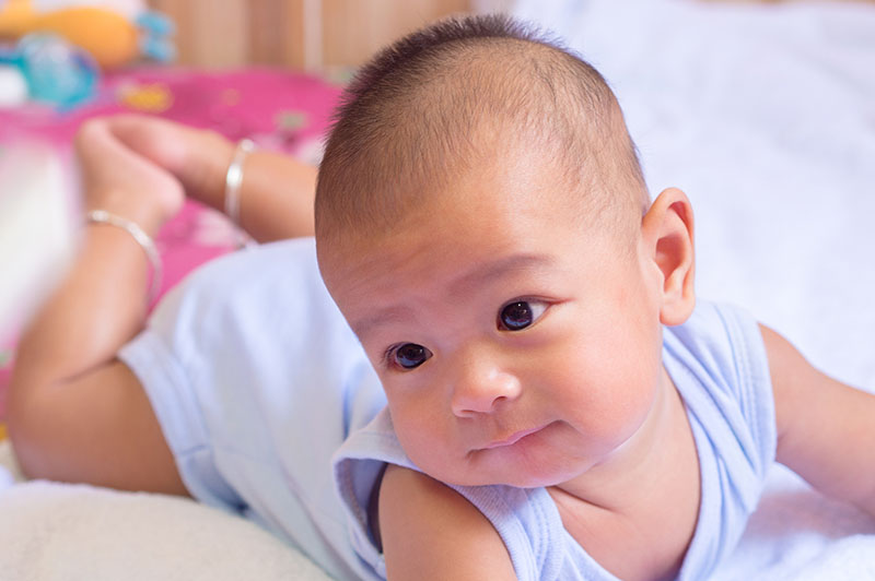 812595044_Plagiocephaly